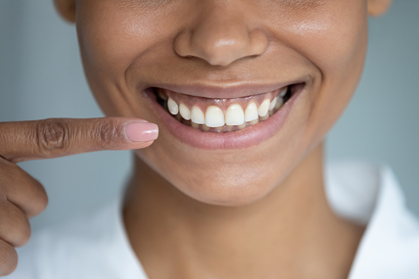 Close up african woman point finger at perfect straight hollywood white toothy smile. After whitening dental treatment procedure showing result, health stomatology dentistry service, oralcare concept