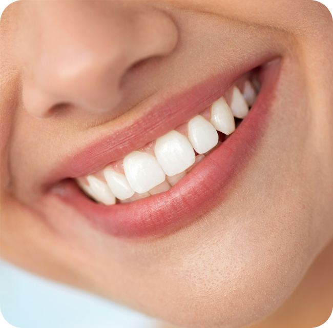 Closeup Of Smiling Woman Mouth With Natural Plump