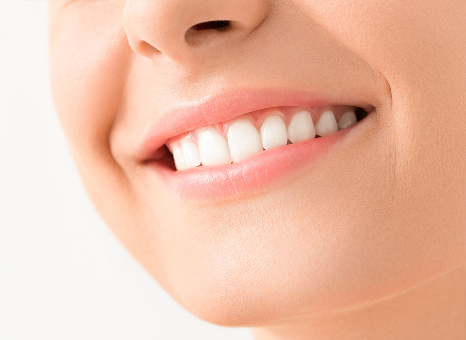 Beautiful female smile after teeth whitening procedure