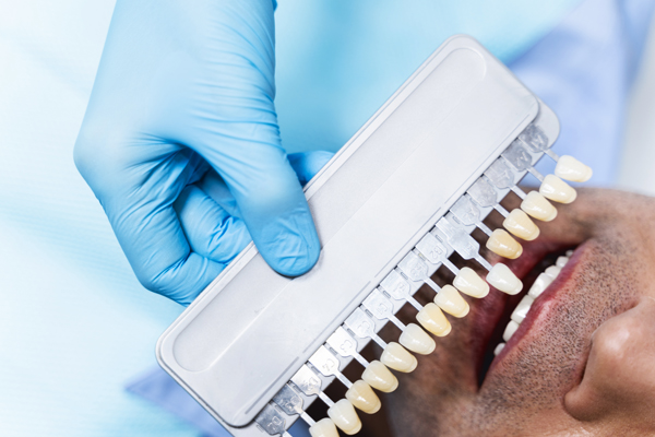 Cheerful male is lying in dental chair while doctor is helping him before whitening teeth