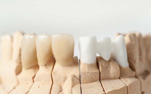 Technical shots on a dental prothetic laboratory