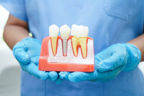 man holding teeth structure