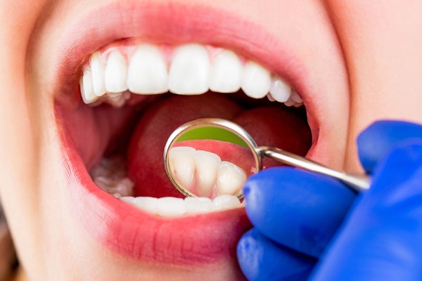 Taking,Care,Of,Teeth.,Woman,At,The,Dentist.,Woman,In