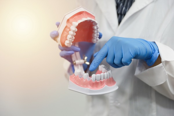 The,Hands,Of,A,Dentist,Doctor,Hold,A,Model,Of