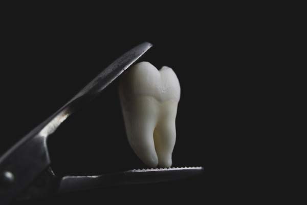 bad real tooth removed in the dental forceps on black isolated background