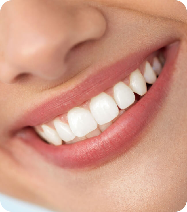 Closeup Of Smiling Woman Mouth With Natural Plump