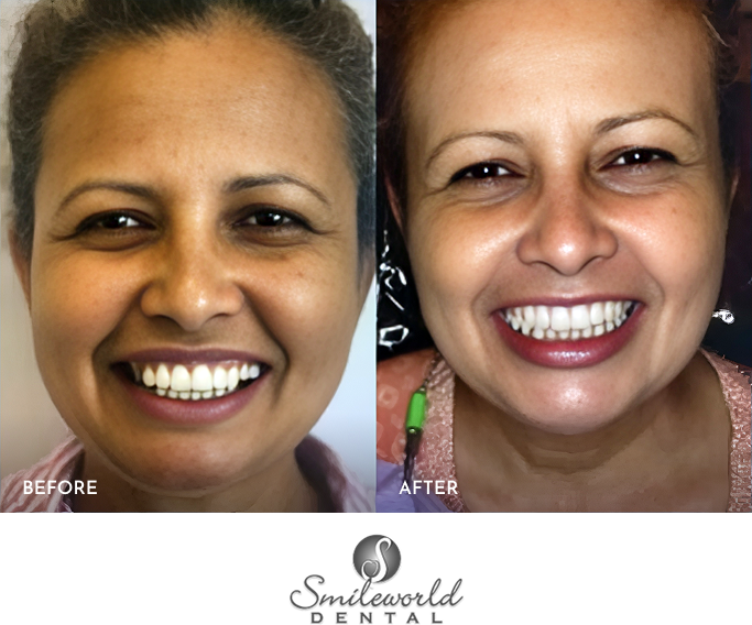 Before and after picture