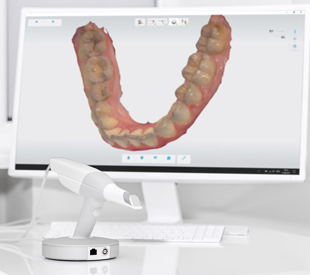 Salida 3D Cone Beam and 3D Dental Scans