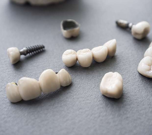 Salida The Difference Between Dental Implants and Mini Dental Implants